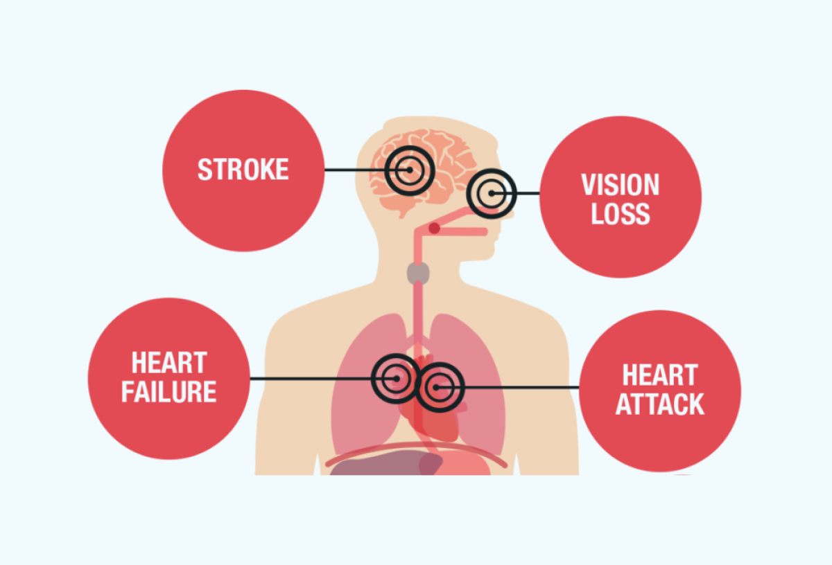 4 health problems that could become silent killers